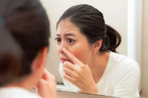 5 Mitos Tentang Jerawat yang Justru Membahayakan Kulit Anda