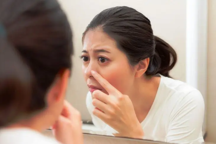 5 Mitos Tentang Jerawat yang Justru Membahayakan Kulit Anda