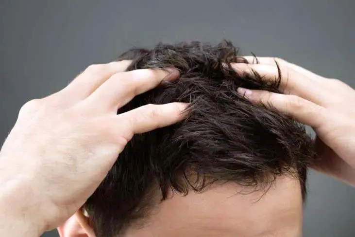 Vitamin Rambut untuk Pria: Atasi Kebotakan Dini dan Rambut Rontok
